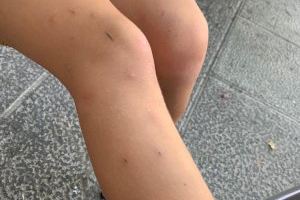 Cs Torrent exige limpieza inmediata del parque de la Avenida Vía Olímpica ante la aparición de una plaga de pulgas - (foto 3)