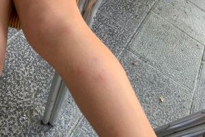Cs Torrent exige limpieza inmediata del parque de la Avenida Vía Olímpica ante la aparición de una plaga de pulgas - (foto 4)