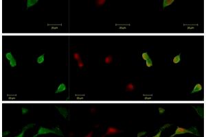 La UMH y la spin-off AntalGenics participan en un proyecto europeo para estudiar y tratar el dolor crónico mediante nanopartículas