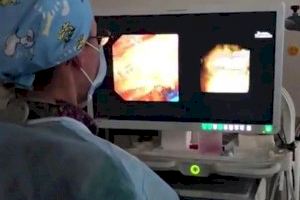 El hospital de Gandia incorpora un endoscopio de última generación que evitará realizar cirugías El hospital de Gandia incorpora un endoscopio de última generación que evitará realizar cirugías