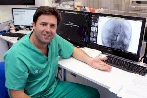 El Hospital General de València incorpora una nueva técnica para el tratamiento de aneurismas cerebrales