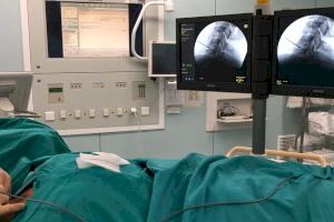 La Unidad de Dolor del Hospital La Fe utiliza una técnica pionera en España para tratar el dolor cervical