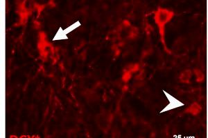 El estrés infantil incrementa alteraciones neuronales y del comportamiento causadas por la falta de Mecp2 - (foto 2)