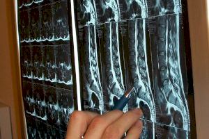 La Unidad de Espalda del Hospital de Manises realizó más de 650 cirugías en 2023