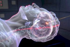 Nuevo avance en el tratamiento contra el cáncer: Valencia albergará un acelerador lineal compacto de iones