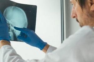 El CSIC participa en un proyecto europeo para lograr un control diario del tratamiento del cáncer de hueso